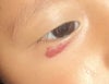 red skin pigmentation under the right eye