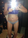 Standing 6 days post op.