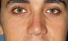 my nose before