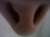 Inferior view
