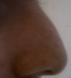 right lateral. left lateral is very similar, but the max amount of photos I can post is 4.