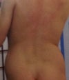 back view