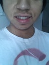 front view. Sorry I'm having issues with rotating the pics