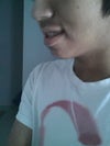 Left side.
