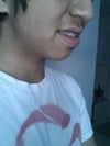 Right side. Notice the longer "groove" that tugs on the nose more than the left side.