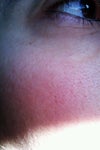 right cheek