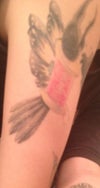 back of arm