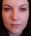 Full Face: Injured side to the right of photograph