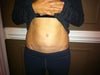 my scar