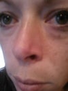 look at the red area... its red because I massage it in hopes it will go down
