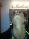 my zygomatic bone
