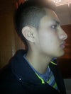 my right side of my face