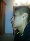my left side of my face