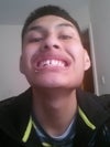 my teeth