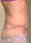 stomach looks round & full
