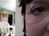 8 months after surgery