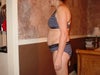 Post surgery. Upper, lower thick belly.