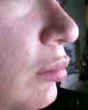 side profile of my nose