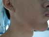 can see the contrast at my mandible here