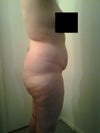 Right Side View