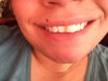 My smile