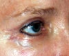 Blue vein 2