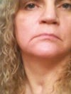 the crease is on the right side of the corner of my mouth