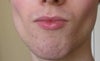 lips before bleach