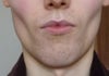 lips after bleach