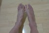 trauma caused by broken ankle Nov 2011
