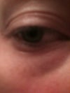 You can't really see the Bumps with an iphone