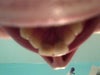 View of front crowns from behind.