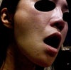 How it looks when I don't open my mouth