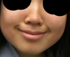 the chubbiness is more pronounced when smiling