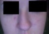 you can see my nose is bent at the center, then curves back at the bottom.