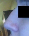 my right side