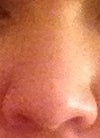 Frontal view