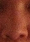 Frontal view 2