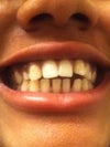 Teeth