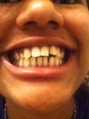 Teeth