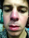 Front view (nose)