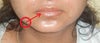 when I Press at the circled place, a current passes to my lip as shown by the arrow.