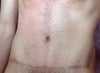 Frontal view.