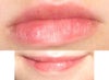 When her mouth is closed, or she smiles without teeth, it is not as noticible.