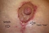 Close up of right nipple