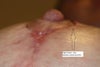 Right nipple from below, added to show the size of the gap between the nipple and skin