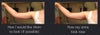 Wish pic arms