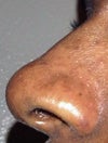 my nose is too big for my face and don't have any shape to it
