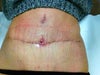Yday,a week since the hole appeared still seeping, but less so