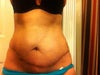 7 1/2 weeks post op